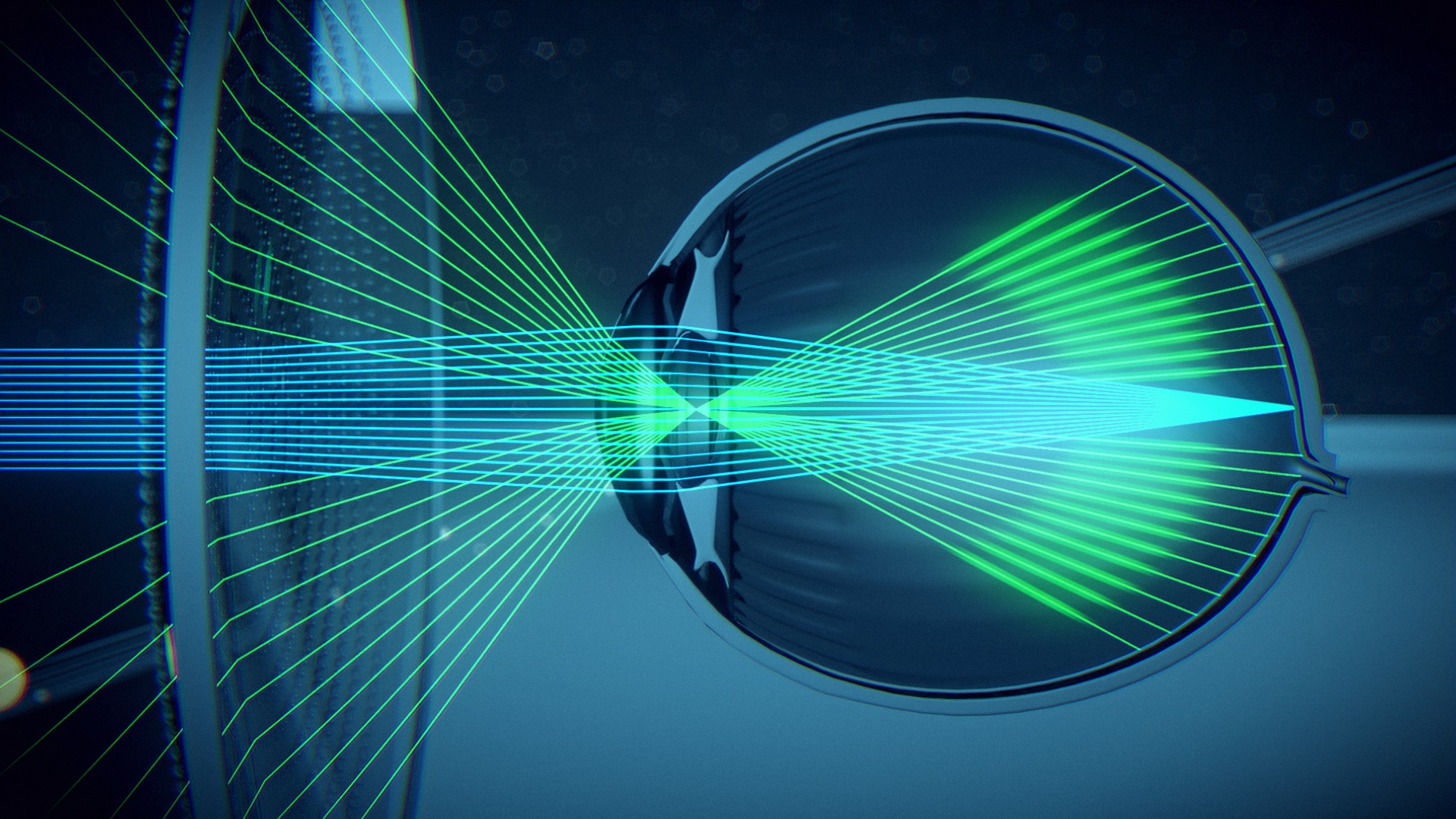 targeting myopia blog support